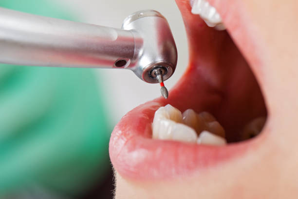 Best Mobile Emergency Dentist in Ellicott City, MD